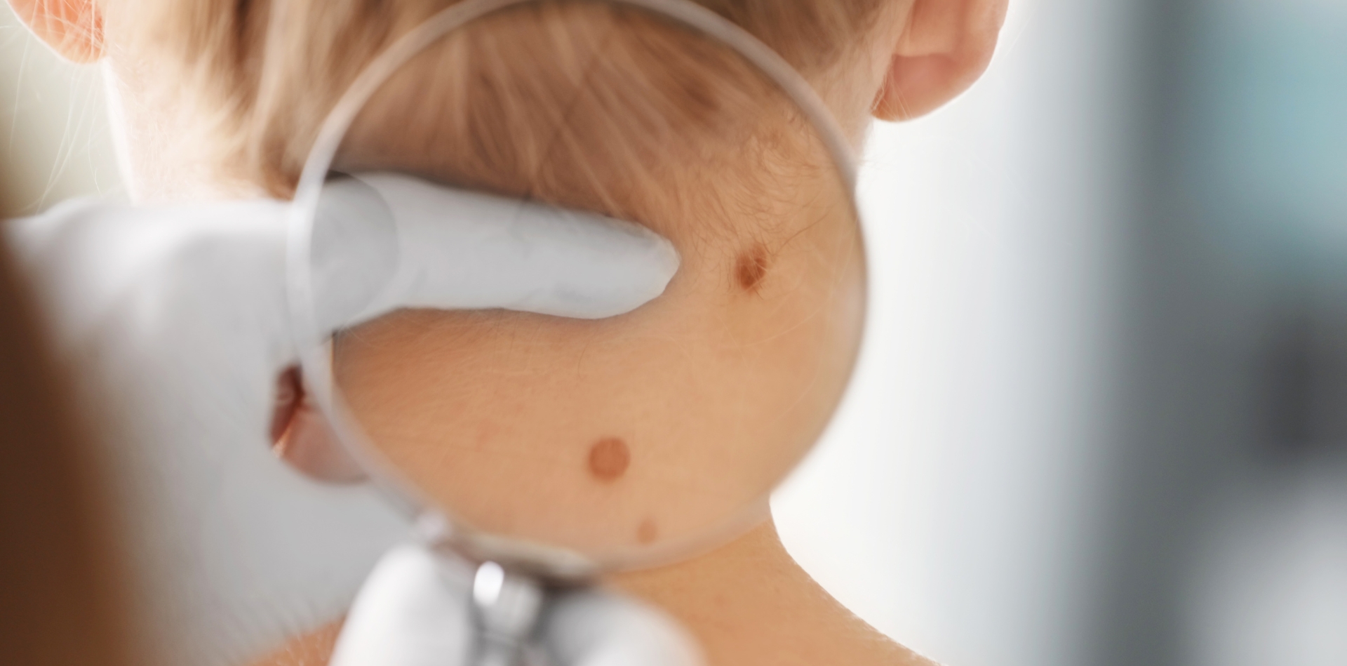 Consulenza dermatologica specialistica a Rende